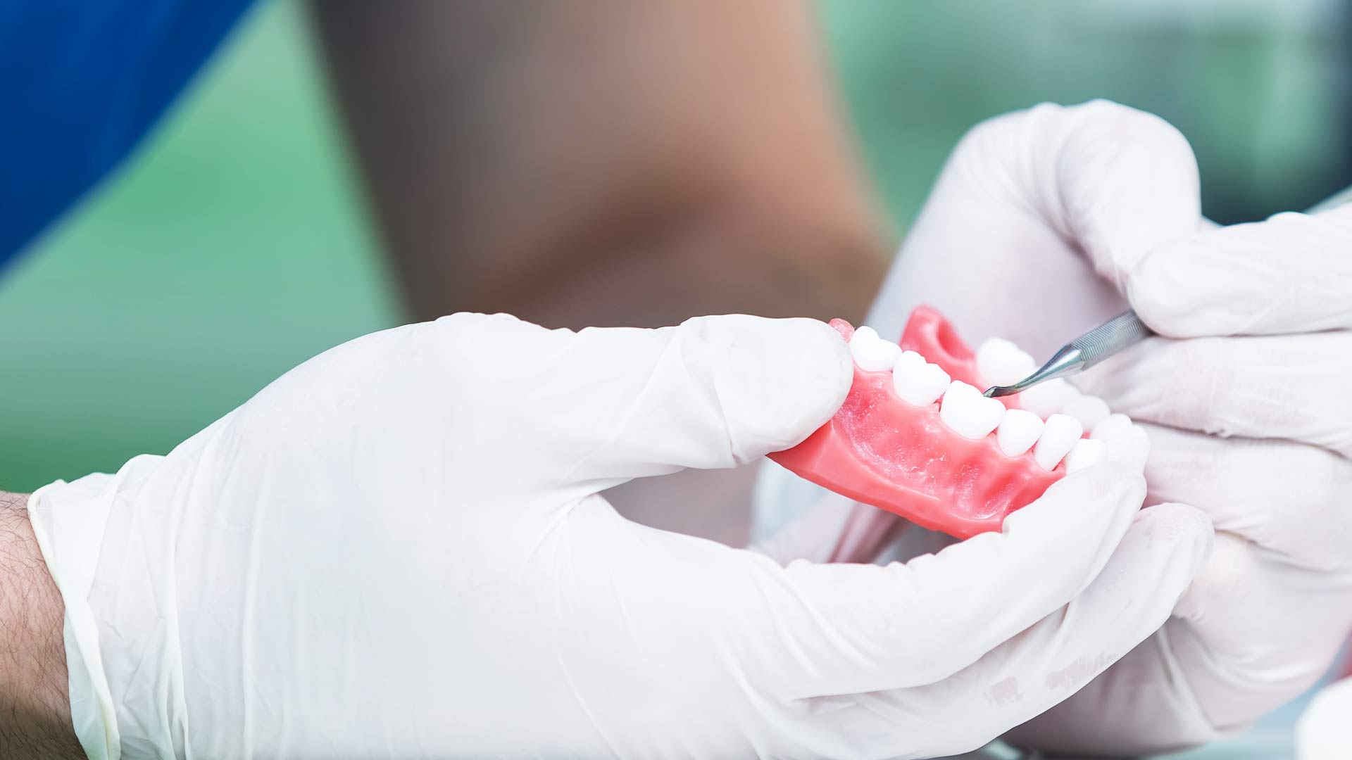 Dentures for Missing Teeth in Perth - Genesis Dental