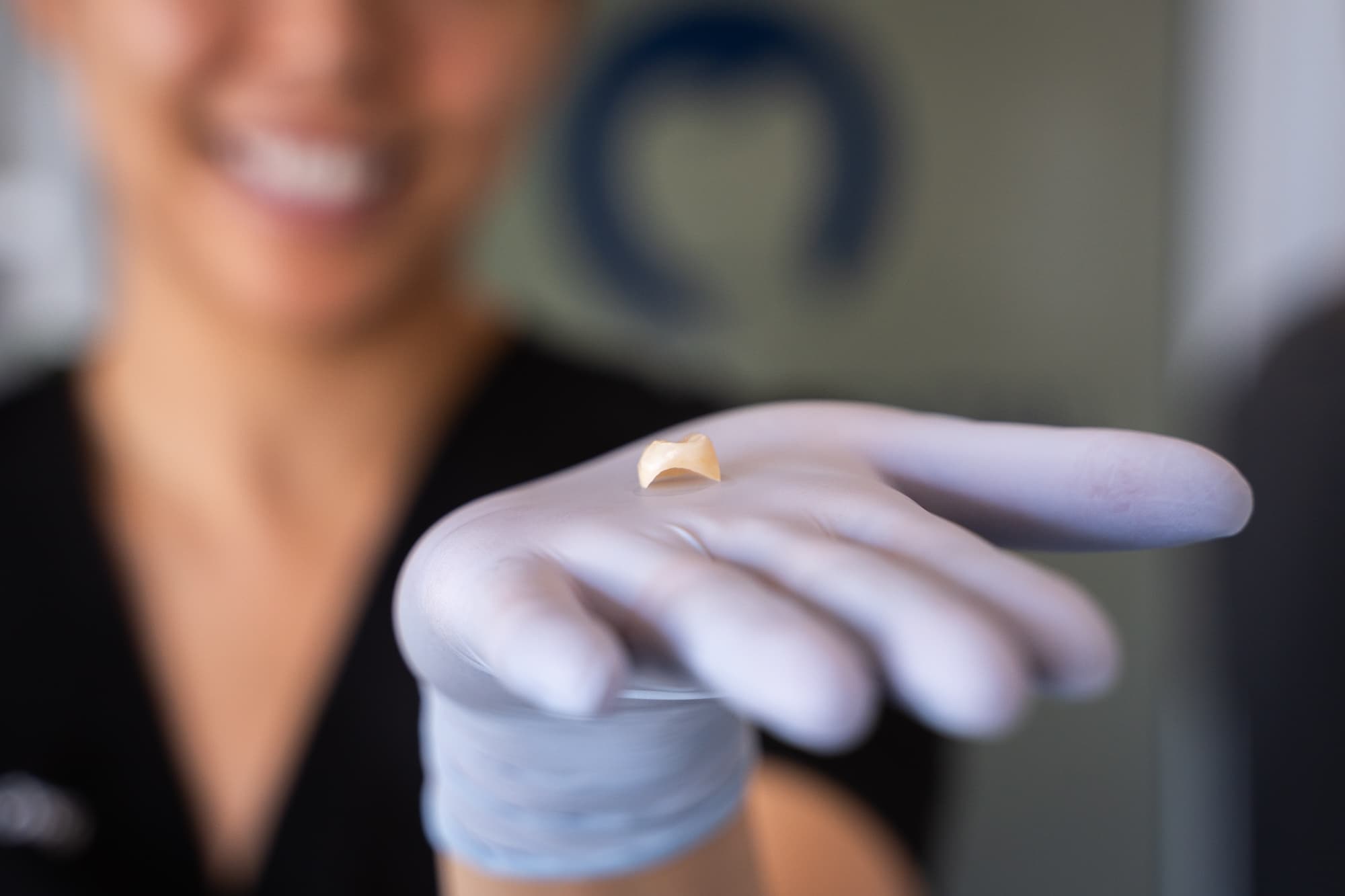 A crown being shown to tell what is a dental crown and bridge