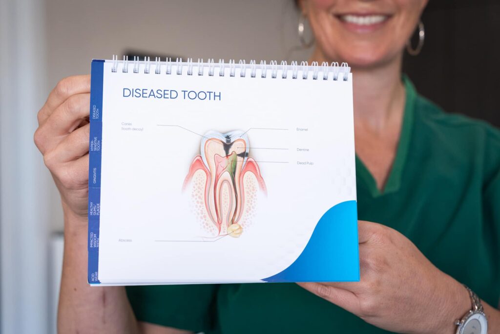 Common Causes Of Periodontitis - Genesis Dental Canning Vale