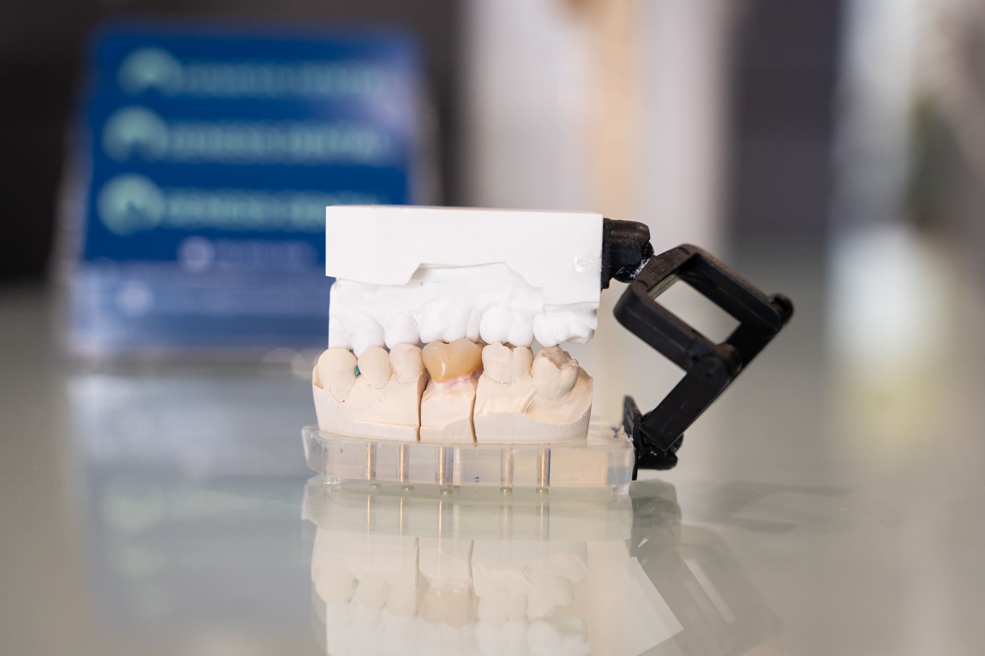 Tooth model of an under bite as an example of a maloccusion